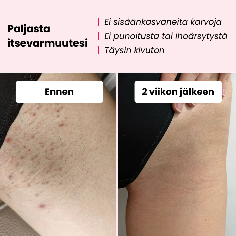 Glowie™ karvanpoistopaketti