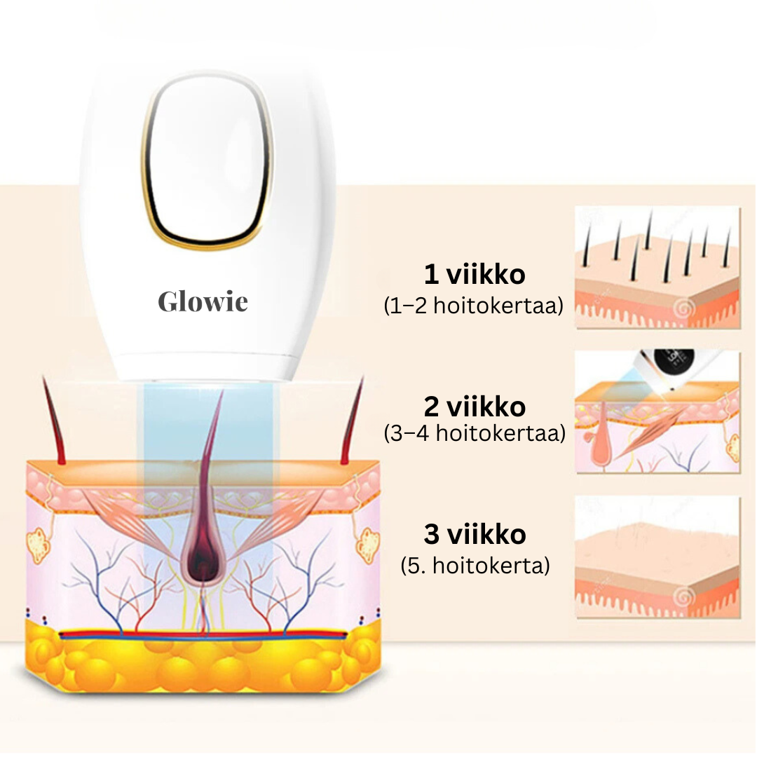 Glowie™ karvanpoistopaketti